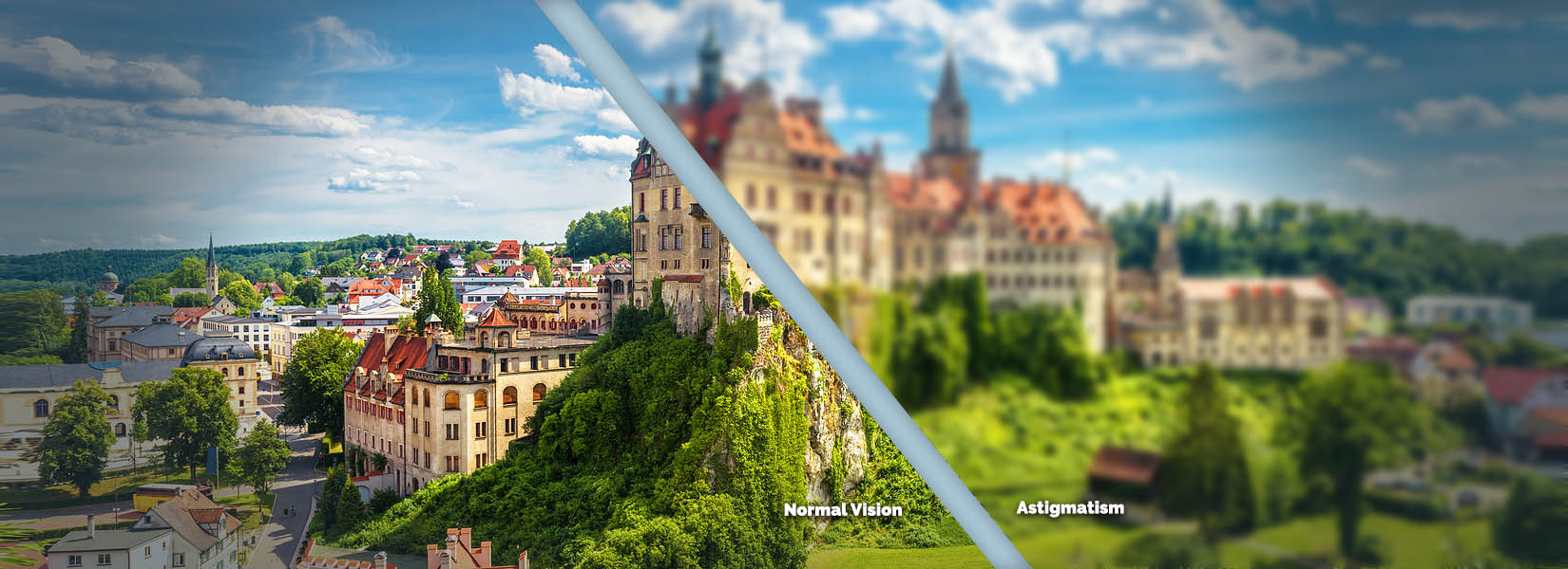 Astigmatism Treatment in Colorado Springs