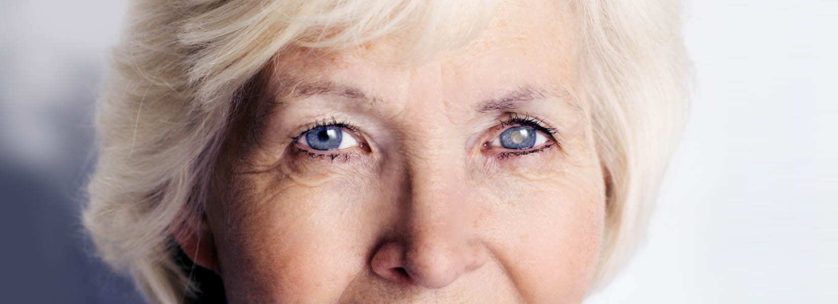 Cataract Surgery in Colorado Springs